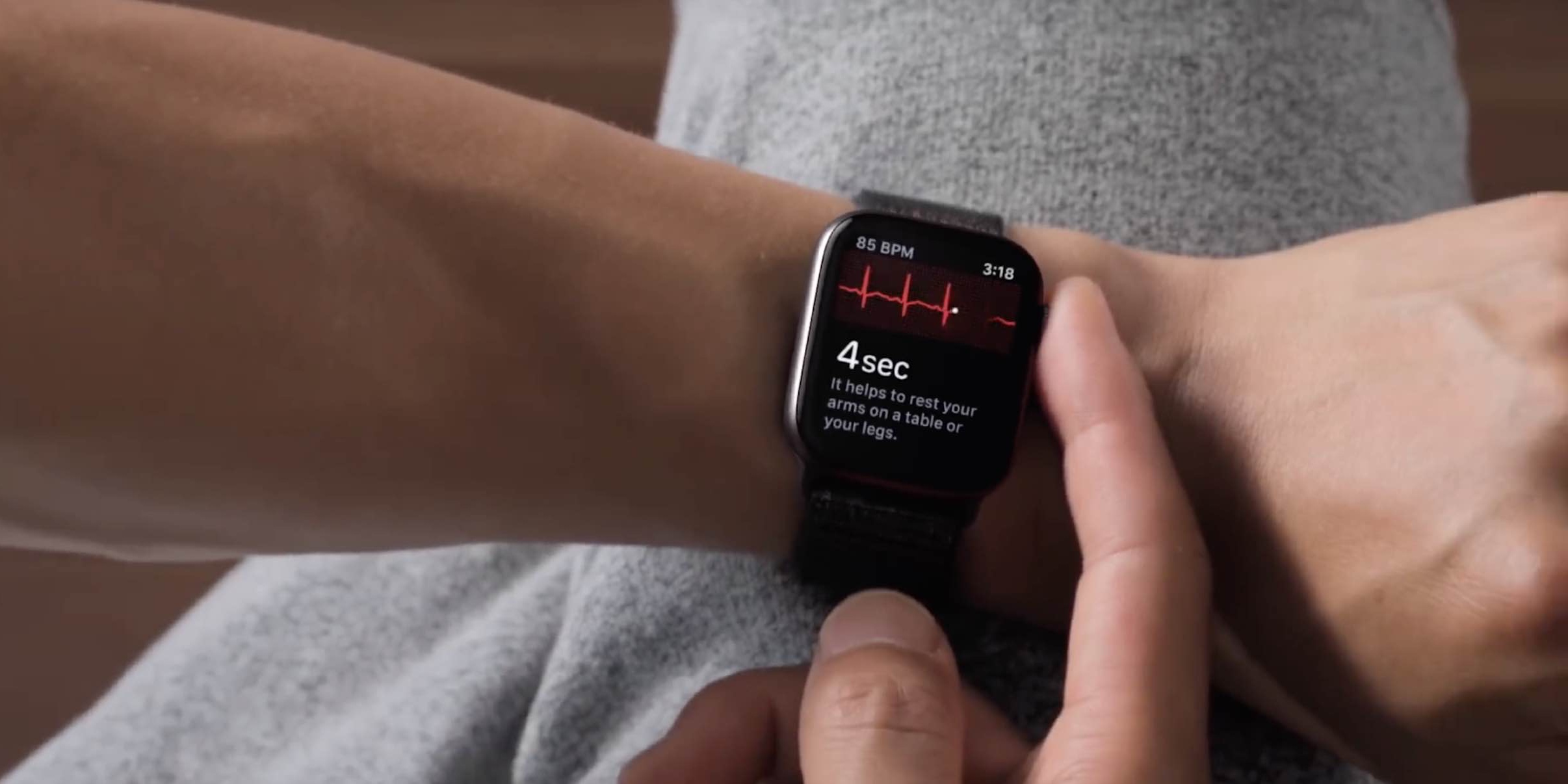 como funciona ecg apple watch