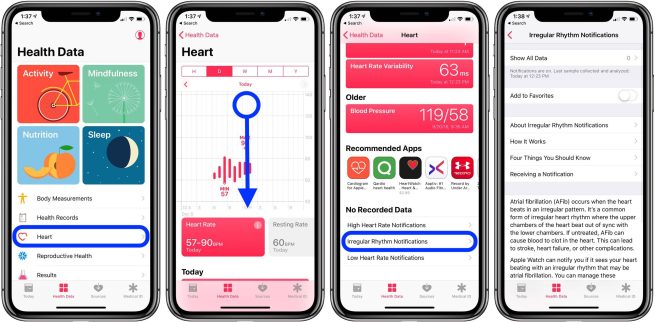 How To Set Up Apple Watch Irregular Heart Rate Notifications 9to5mac 6901