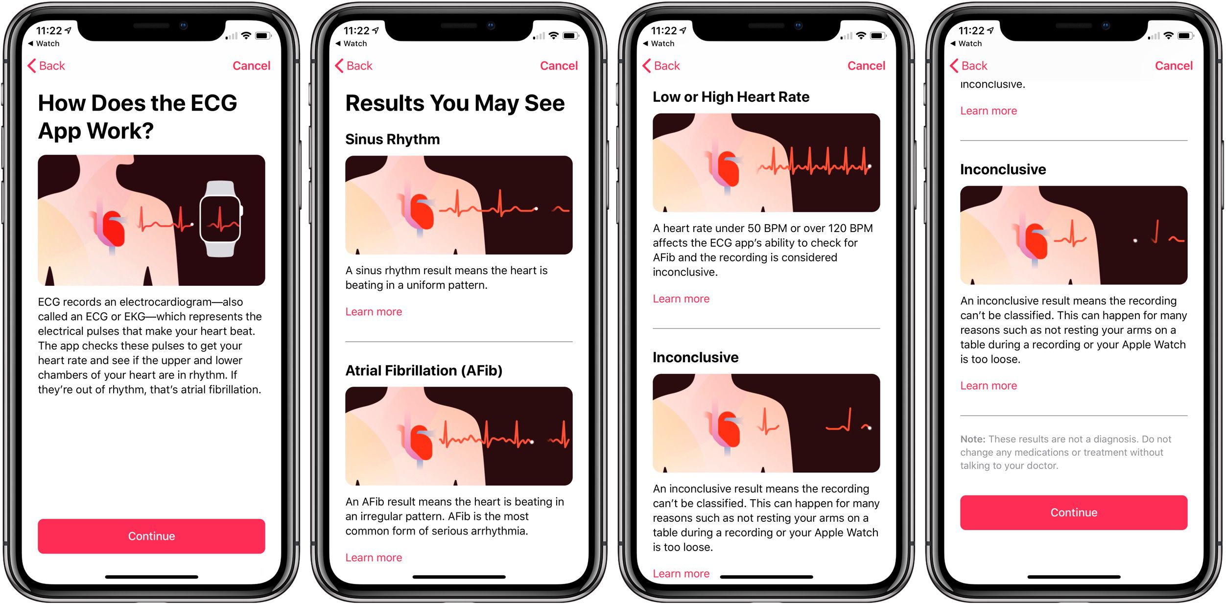 como funciona ecg apple watch