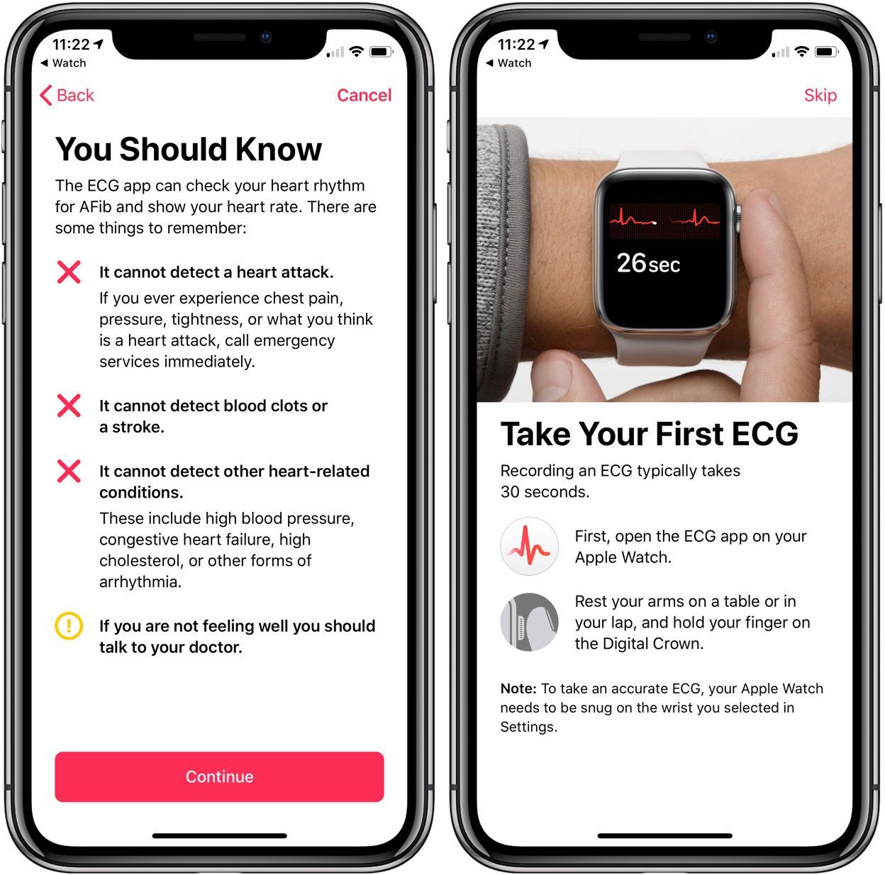 How to take an ECG (electrocardiogram) on Apple Watch [Gallery] - 9to5Mac