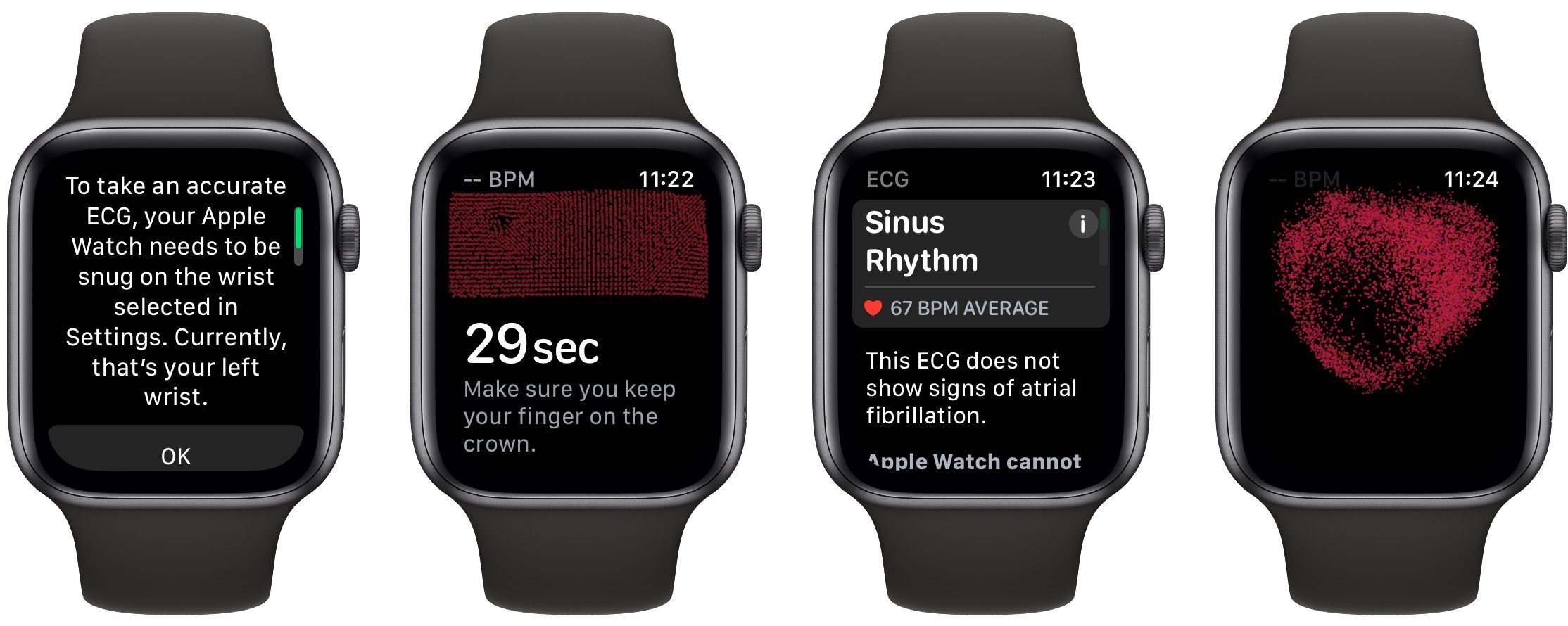 How to take an ECG (electrocardiogram) on Apple Watch [Gallery] - 9to5Mac