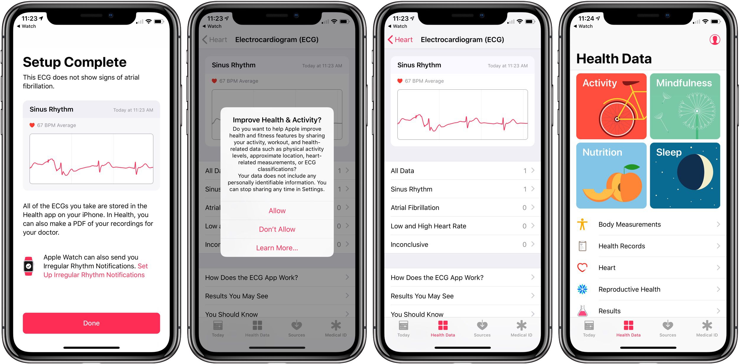 Ekg on apple online phone