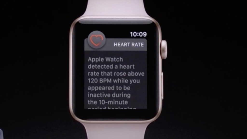 apple watch irregular heartbeat