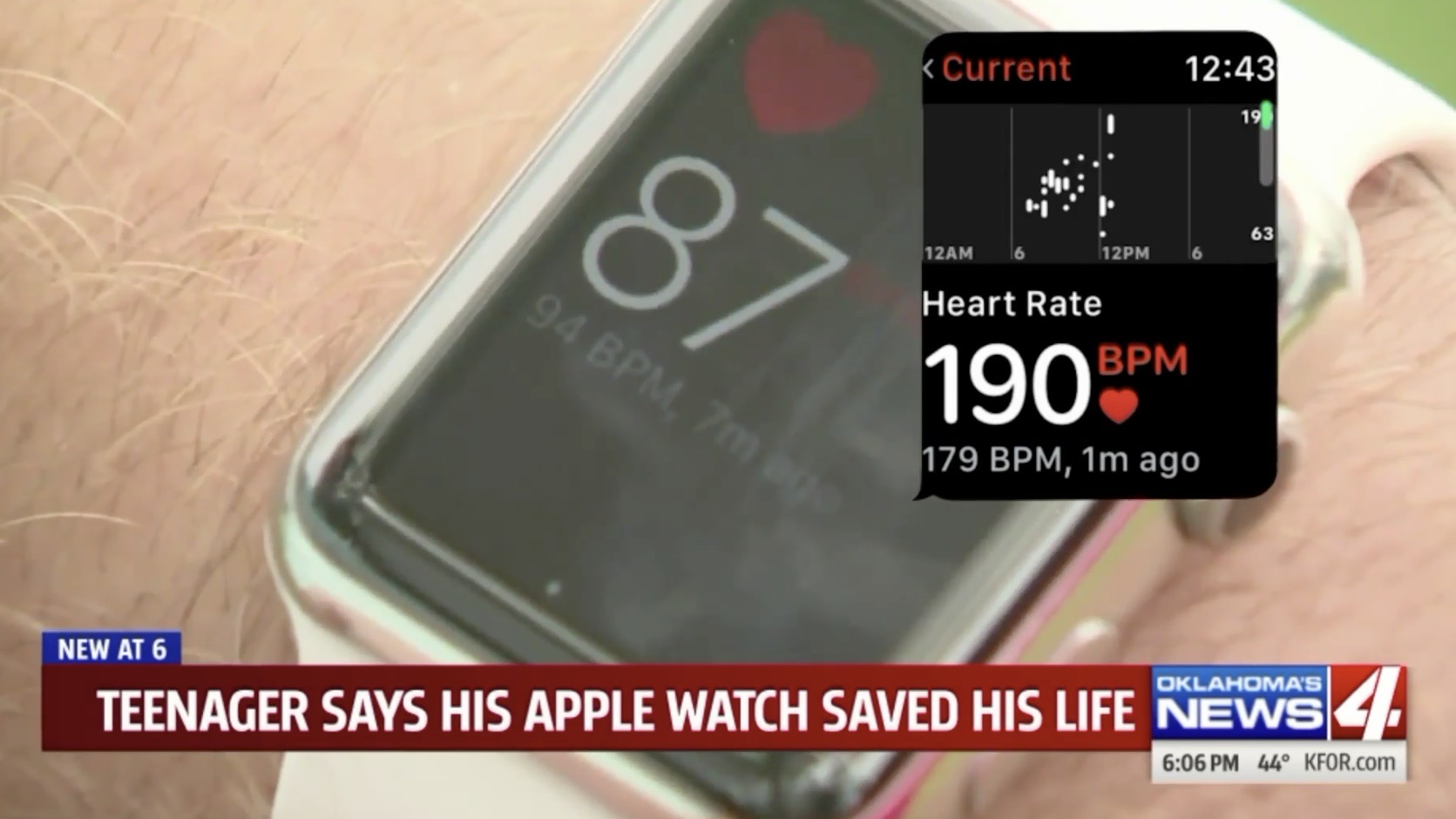 photo of Oklahoma mom credits Apple Watch with detecting SVT heart rhythm in her 13 year-old son image