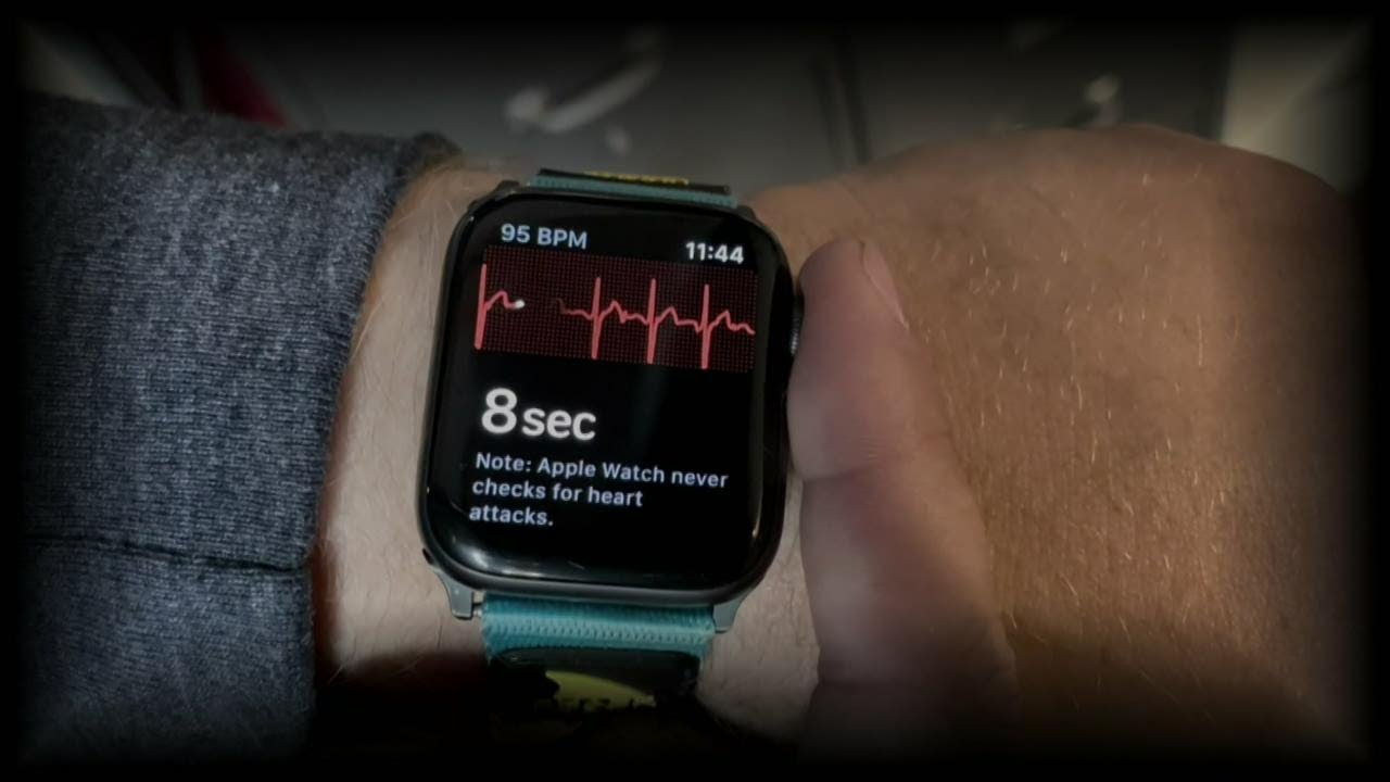 apple watch 7 ekg