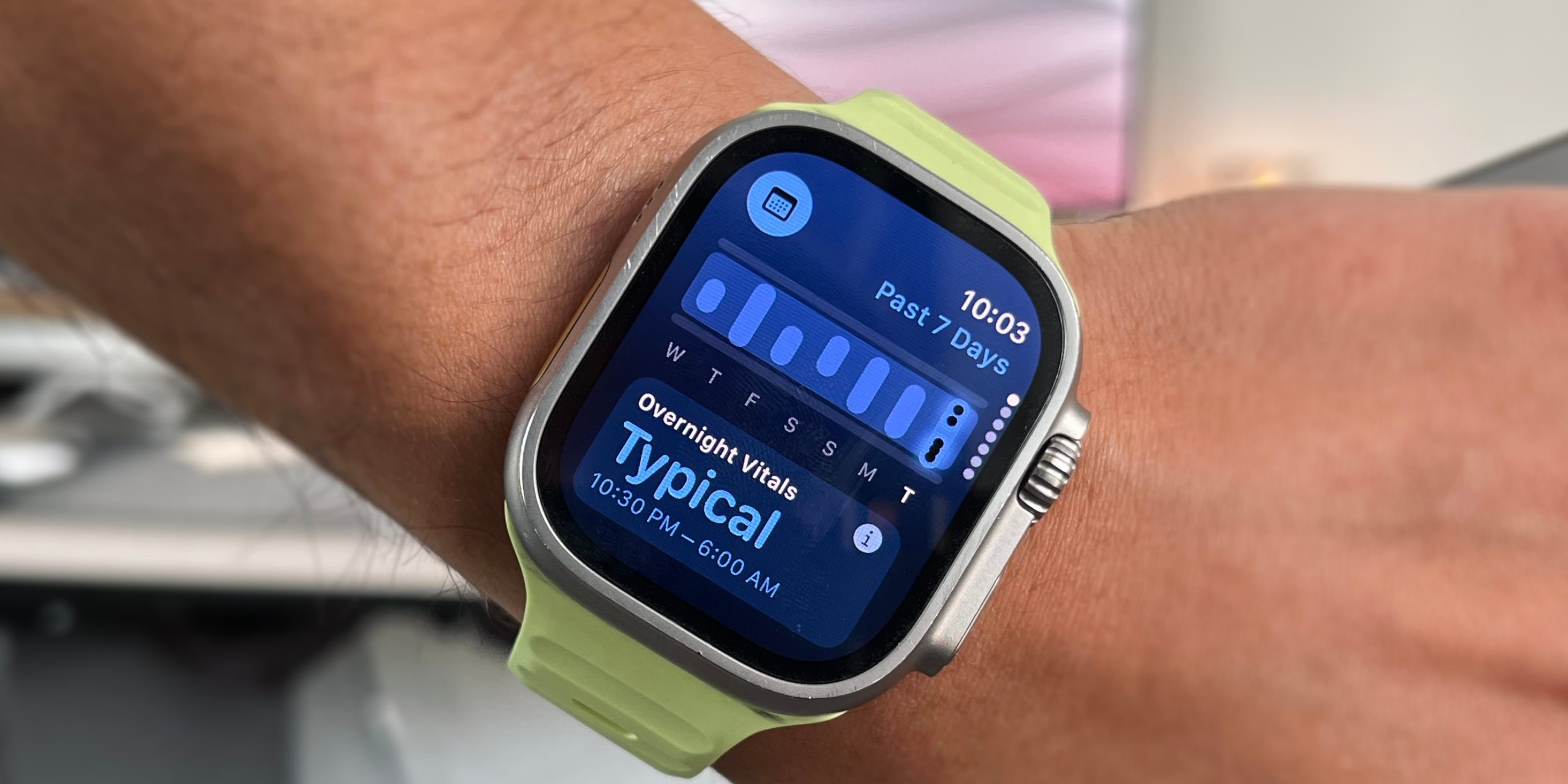 Мои любимые функции watchOS 11 в этом году [видео]