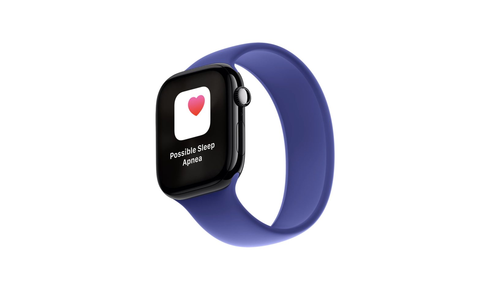 Report: Apple Watch accounted for nearly all Edge AI smartwatch shipments in Q1 2026