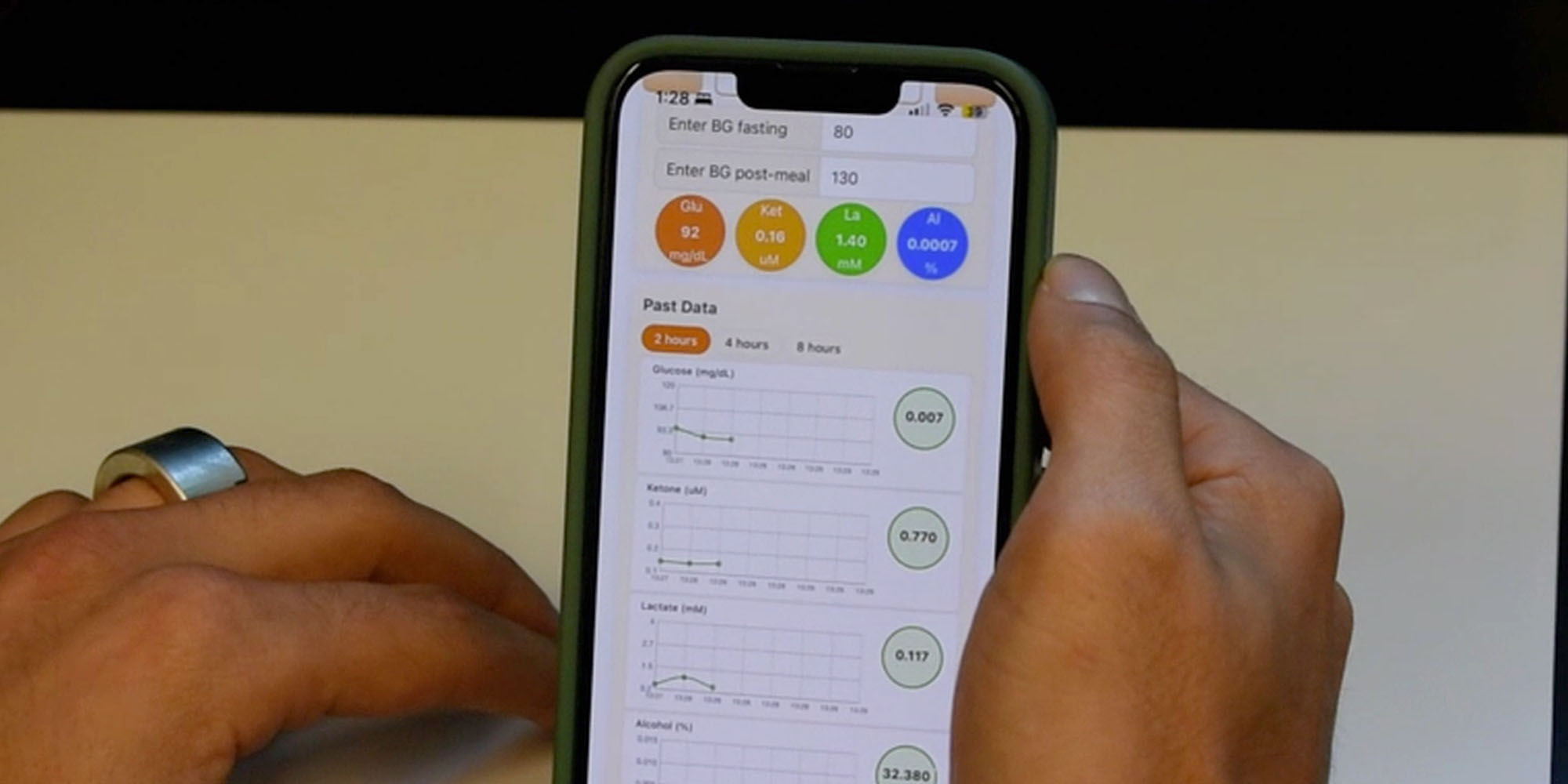 Prototype smart ring developed by University of California engineers measures blood sugar and other biomarkers using sweat analysis