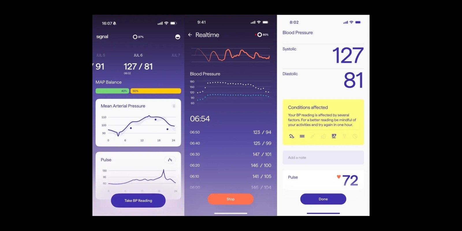 Signal Ring claims blood pressure readings without cuff calibration