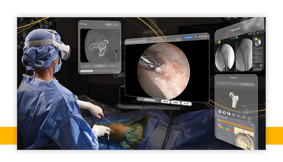 Apple Vision Pro was just used in a first-of-its-kind surgery